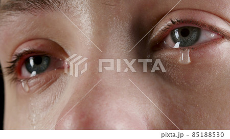 Close-up image of the woman's tearing eye 85188530