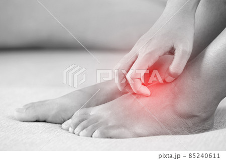 Man's legs have symptoms Itchy feet caused by fungi Man's legs have symptoms Itchy feet caused by fungi 85240611