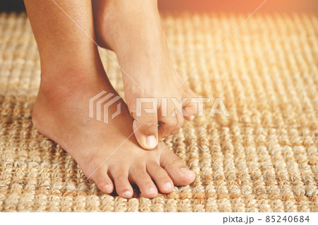 Fungal foot itching caused by biting feet Fungal foot itching caused by biting feet 85240684