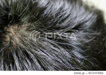 日本人男性の頭皮 日本人男性の頭皮 85245966