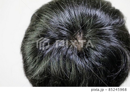 日本人男性のつむじ 85245968