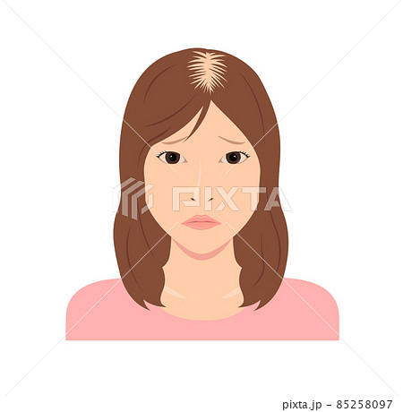 女性のびまん性脱毛症 ベクターイラスト 女性のびまん性脱毛症 ベクターイラスト 85258097