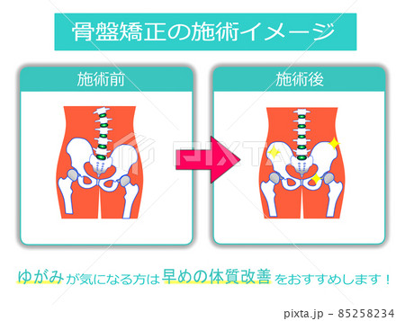 治療院用 ホームページ 説明素材5 治療院用 ホームページ 説明素材5 85258234