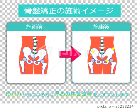 治療院用 ホームページ 説明素材5 治療院用 ホームページ 説明素材5 85258234