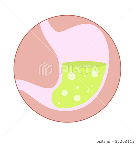 Human stomach. Internal organ of body. 85263115