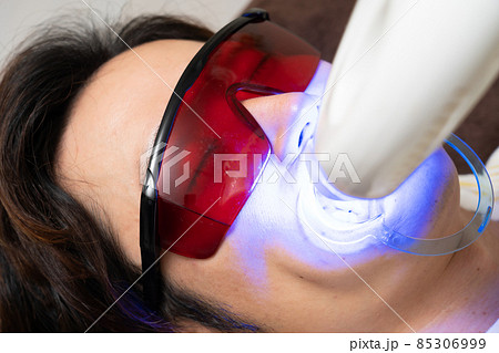 歯のホワイトニングをする男性 85306999