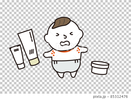 Rough skin baby 85312476