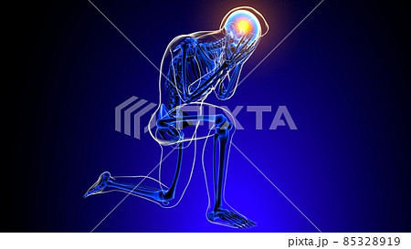 Headache pain Anatomy For Medical Concept 3D Headache pain Anatomy For Medical Concept 3D 85328919