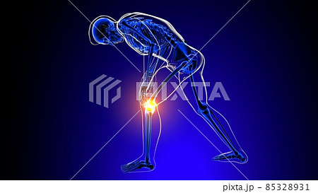 Knee joint pain Anatomy For Medical Concept 3D 85328931