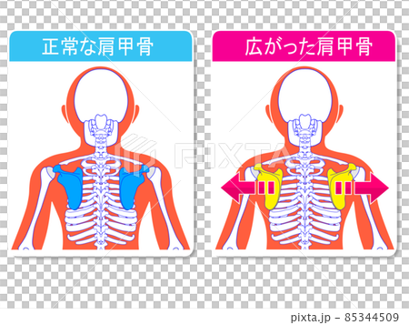 普通肩blade骨和加寬肩shoulder骨 普通肩blade骨和加寬肩shoulder骨 85344509