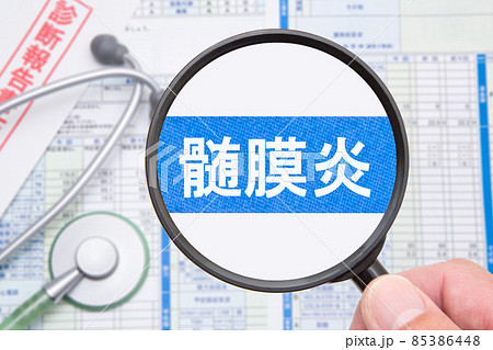 髄膜炎　医療イメージ 85386448