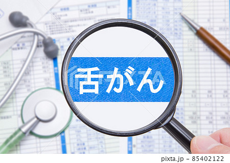 舌がん　医療イメージ　 85402122