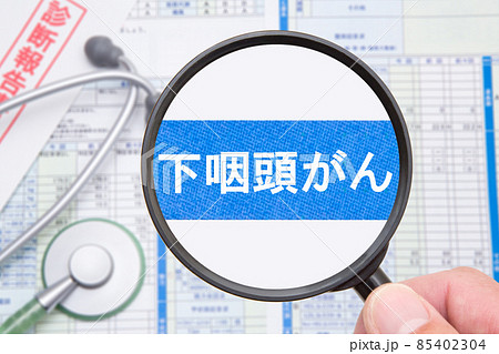 下咽頭がん 医療イメージ 下咽頭がん 医療イメージ 85402304