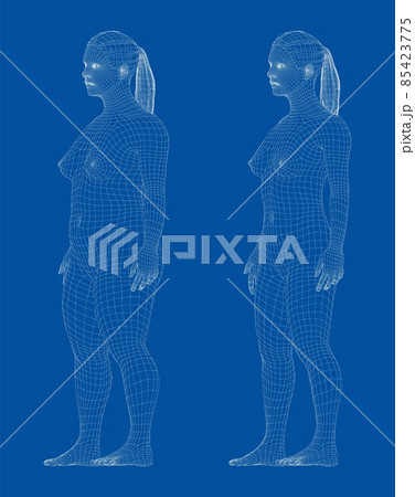 Fat and slim woman, before and after weight loss 85423775