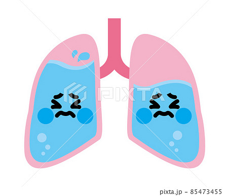 肺 キャラクター 肺水腫のイラスト素材