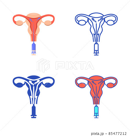 Intrauterine insemination icon set in flat and line style 85477212
