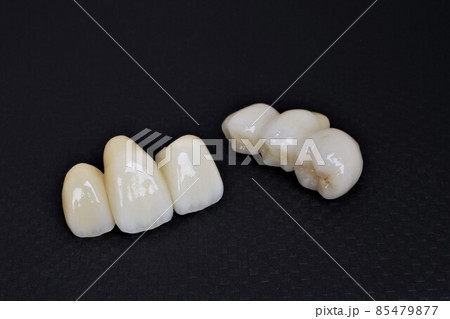 マスク生活のうちに歯医者で歯を綺麗にしましょう 85479877