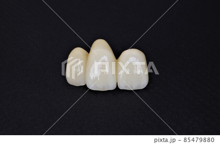 マスク生活のうちに歯医者で歯を綺麗にしましょう 85479880