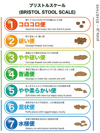 【医療】ブリストル・スケール (BRISTOL STOOL SCALE) による排便の性状分類 縦 85487449