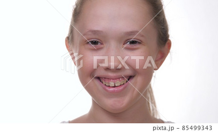 Happy little girl smiling with teeth on white isolated background. Bite correction plate and crooked teeth. The child makes a smile correction in dentistry at the orthodontist. Indications for the 85499343