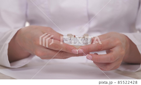A woman orthodontist holds in her hand a plate for correcting teeth and occlusion. To put the plate on the plaster white teeth. Jaw treatment in a specialist doctor's office. A healthy and beautiful 85522428