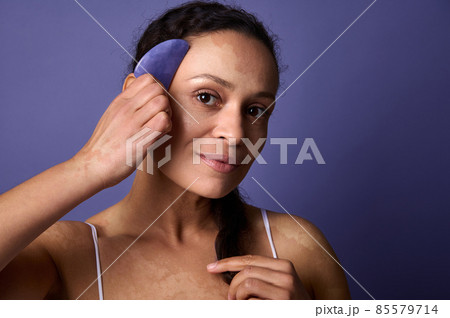 Beautiful middle aged woman with vitiligo smiles cutely looking at camera, and holding jade stone massager near her face. Purple background with copy ad space. Dermatology and skin problems concept Beautiful middle aged woman with vitiligo smiles cutely looking at camera, and holding jade stone massager near her face. Purple background with copy ad space. Dermatology and skin problems concept 85579714