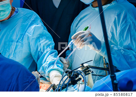 A catheter for suctioning blood in the surgeon's hand during surgery. 85580817