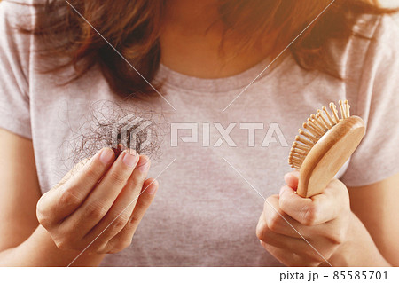 young woman worried about Hair loss problem after comb in hand. problem hormonal disbalance, stress concept. Health care concept 85585701