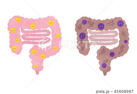 良い菌がいる腸と悪い菌に侵されている腸のイラストセット 85608987