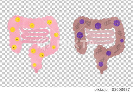 良い菌がいる腸と悪い菌に侵されている腸のイラストセットのイラスト素材