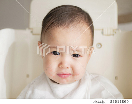 ハーフの赤ちゃんの口元の湿疹　イメージ　 85611869
