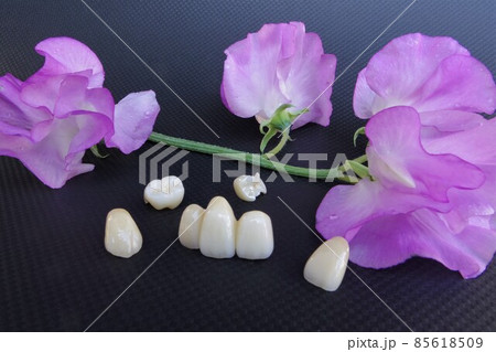 花のようにきれいな歯 花のようにきれいな歯 85618509