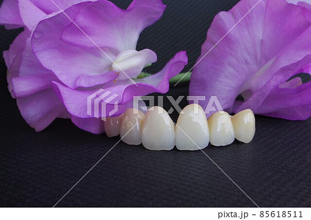 花のようにきれいな歯 花のようにきれいな歯 85618511