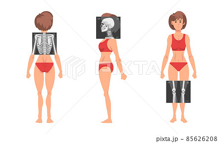 Young Woman Standing in Red Underwear with Her Skeleton X-ray Vector Set 85626208