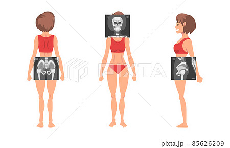 Young Woman Standing in Red Underwear with Her Skeleton X-ray Vector Set 85626209