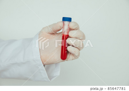 Hand holding a glass of test tube with patient's blood for testing 85647781