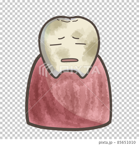 汚れた歯と汚れた歯茎 汚い歯 顔あり 汚れた歯と汚れた歯茎 汚い歯 顔あり 85651010