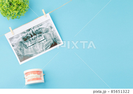 X ray of teeth with jaw model on the dentist table X ray of teeth with jaw model on the dentist table 85651322