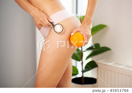 Cellulite problem concept, young woman holding orange near her leg Cellulite problem concept, young woman holding orange near her leg 85653766