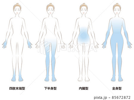 冷え性の4つのタイプ 冷え性の4つのタイプ 85672872