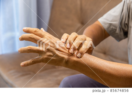 Senior man hand suffering from joint pain with gout inflammation 85674856