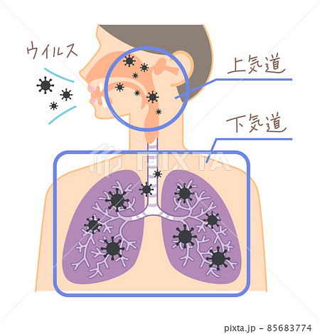 上気道と下気道へのウイルスの侵入（鼻・喉・肺の図表イラスト・文字あり） 85683774