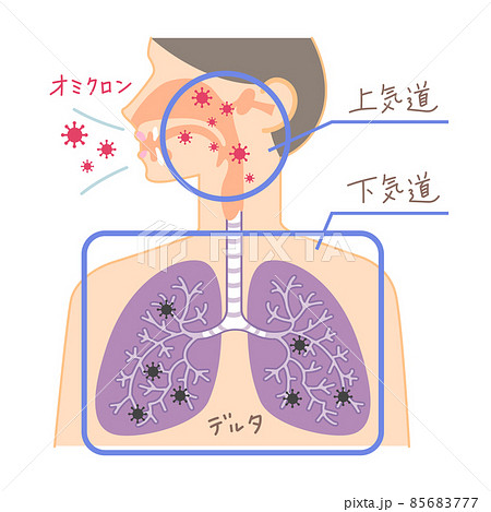 上気道と下気道へのオミクロン株の侵入（鼻・喉・肺の図表イラスト・文字あり） 85683777