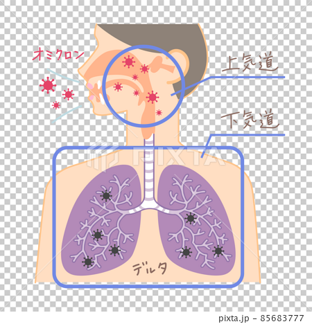 上気道と下気道へのオミクロン株の侵入（鼻・喉・肺の図表イラスト・文字あり） 85683777