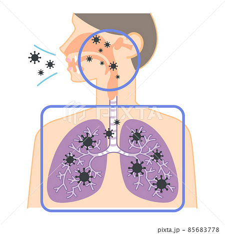 上気道と下気道へのウイルスの侵入（鼻・喉・肺の図表イラスト） 85683778