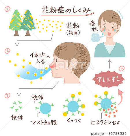 花粉症のしくみのイラスト 説明図 図表 アレルギーのイラスト素材