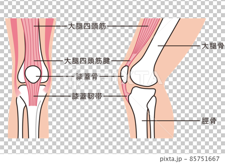 膝関節 説明図 スポーツ障害 ジャンパー膝 膝関節 説明図 スポーツ障害 ジャンパー膝 85751667