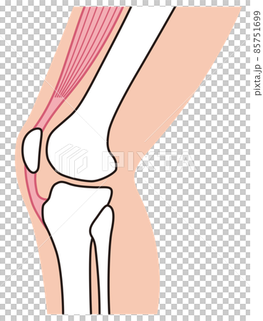 膝関節　説明図　スポーツ障害　ジャンパー膝 85751699