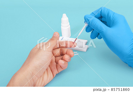 Doctor making Coronavirus COVID-19 quick Rapid Diagnostic Test RDT, Scientist worker place collected patient finger prick blood sample specimen on cassette, COVID-19 antigen rapid test concept Doctor making Coronavirus COVID-19 quick Rapid Diagnostic Test RDT, Scientist worker place collected patient finger prick blood sample specimen on cassette, COVID-19 antigen rapid test concept 85751860