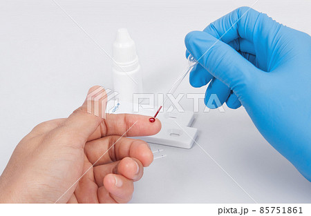 Doctor making Coronavirus COVID-19 quick Rapid Diagnostic Test RDT, Scientist worker place collected patient finger prick blood sample specimen on cassette, COVID-19 antigen rapid test concept 85751861